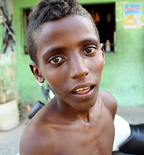 Ein Bild der Wanderausstellung „Jugend in Brasilien“, die demnächst in Pfünz zu sehen ist: Die Auswirkung von Drogen veranschaulichte eine 15-jährige Fotografin aus der Favela Santa Ama-ro in Recife. Foto: Natalie José Florencio
